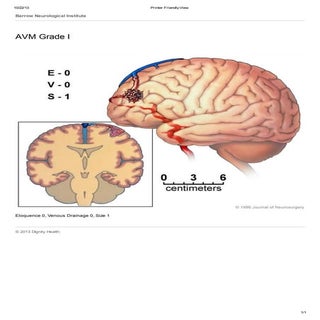 Avm spetzler grading