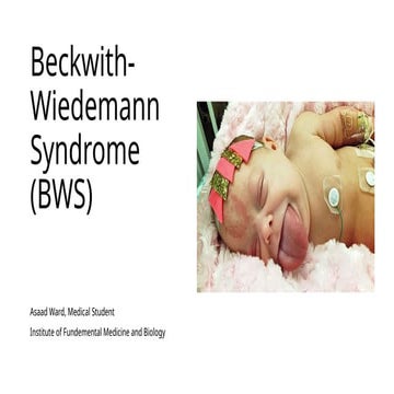 Beckwith Wiedmann Syndrome Genetics PPT General Medicine | PPTX