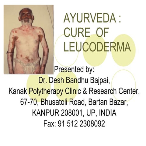 Ayurveda Cure Of Leucoderma