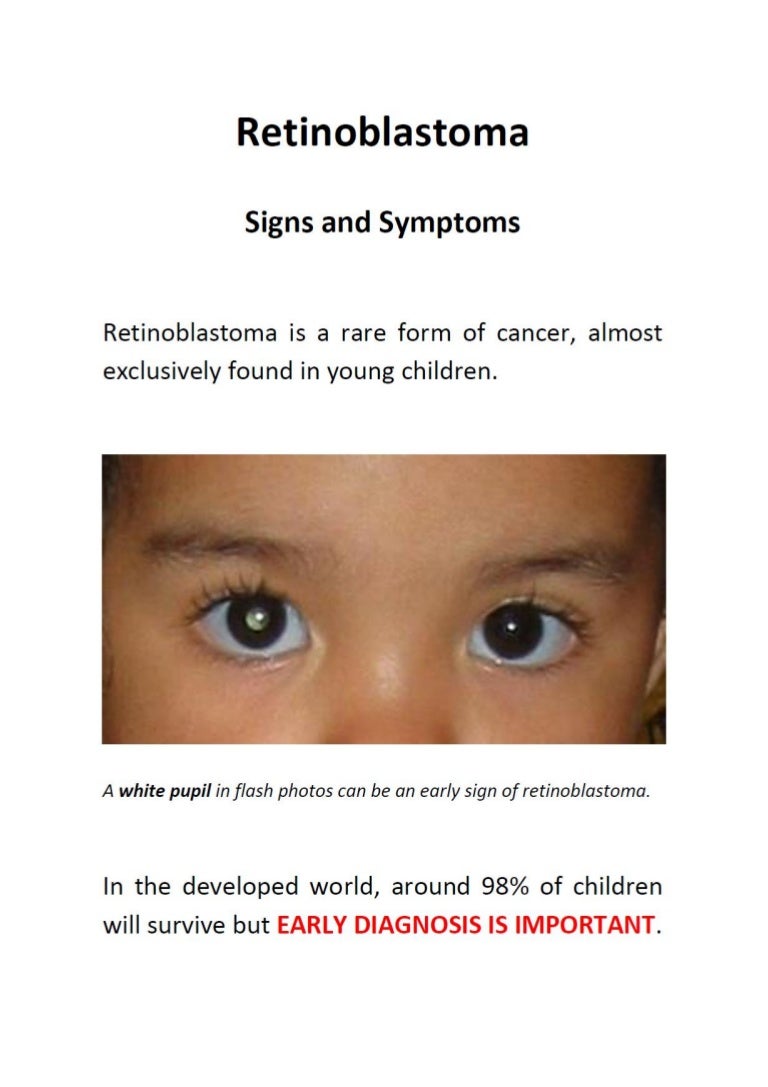 Retinoblastoma Signs and Symptoms