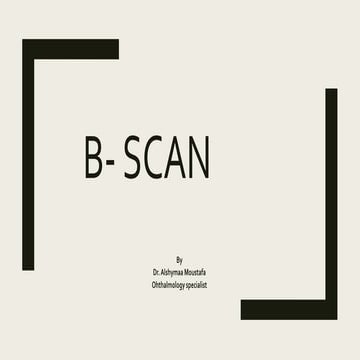 B scan | PPT