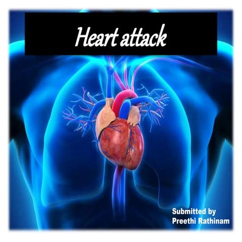heart attack - medical notes 