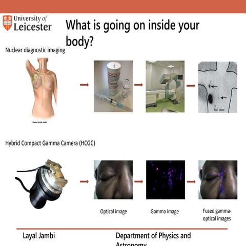 challenges of small field dosimetry | PPTX