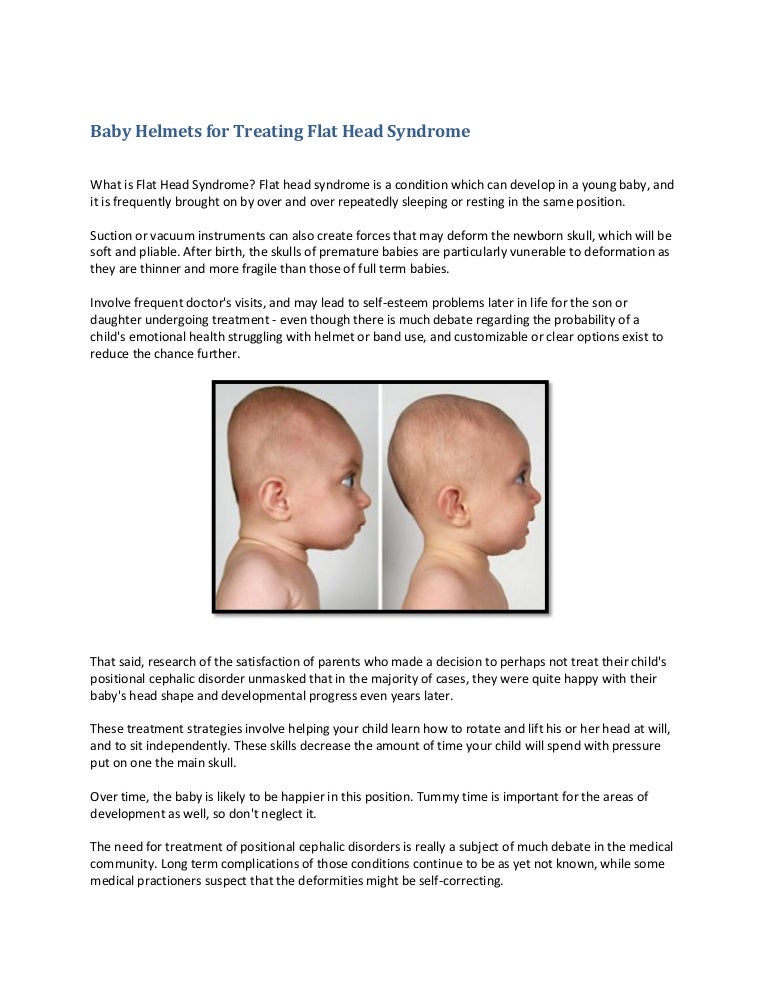 baby sleeping positions to prevent flat head
