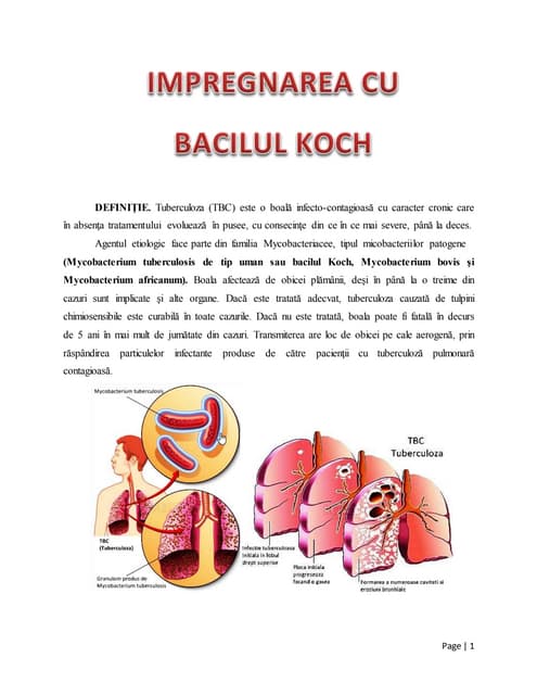 Bacil koch