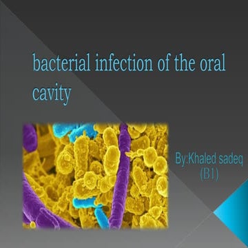 Bacterial infection of the oral cavity (khaled sadeq)