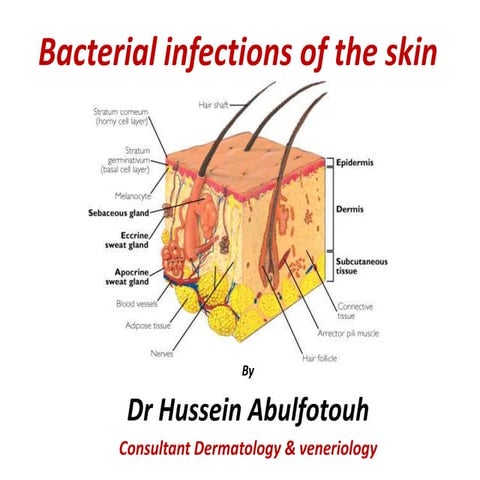 Bacterial infection of the skin 