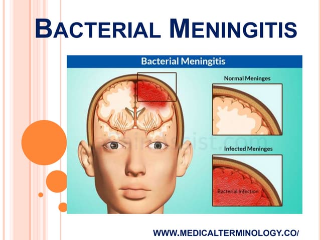 risk factors for hearing loss among newborns (ENT)