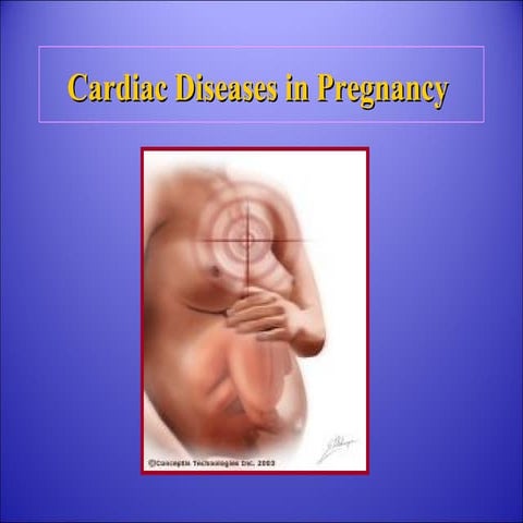 cardiac disease in pregnancy