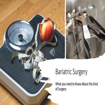 Advantages and Disadvantages of Mini Gastric Bypass Surgery | PPTX