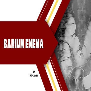 Barium Enema procedure in radiology department