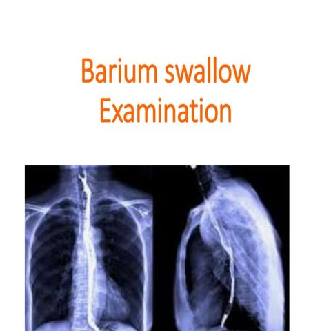 Barium swallow examination