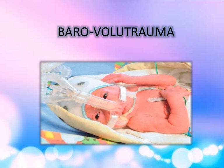 Baro volutrauma