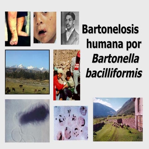 Bartonelosis humana