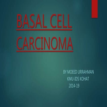 Basaloid squamous cell carcinoma seminar | PPTX