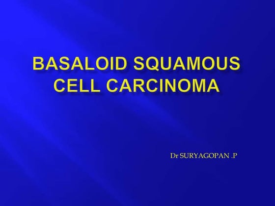 Basal cell carcinoma | PPT