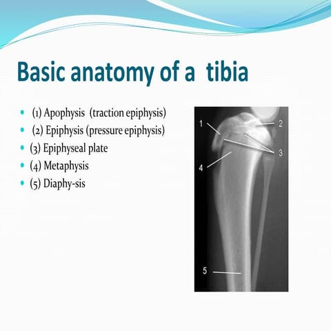 Basic anatomy of a  tibia