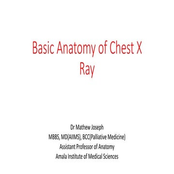 Basic Anatomy of Chest X Ray.pptx