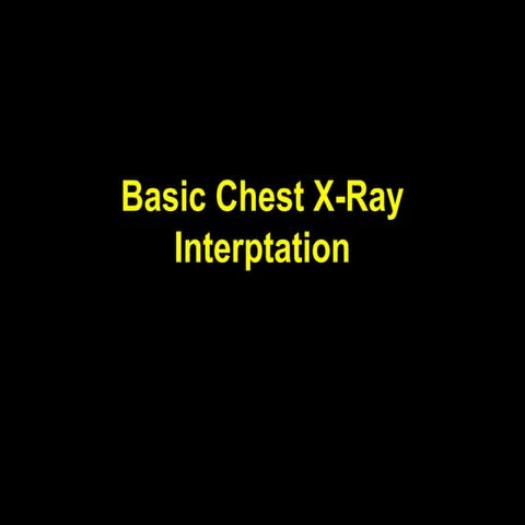 Basic chest x ray interpretation