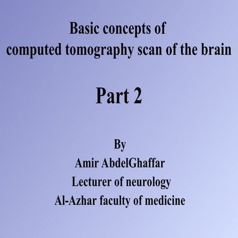 Basic concepts of computed tomography scan of the brain 2.ppt