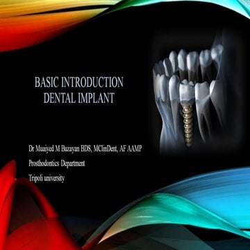 Basic dental implant