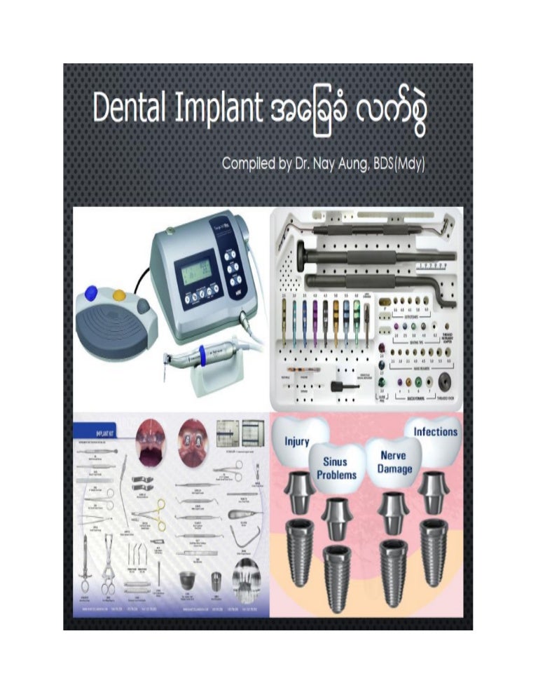 Basic dental implant handbook 20180325