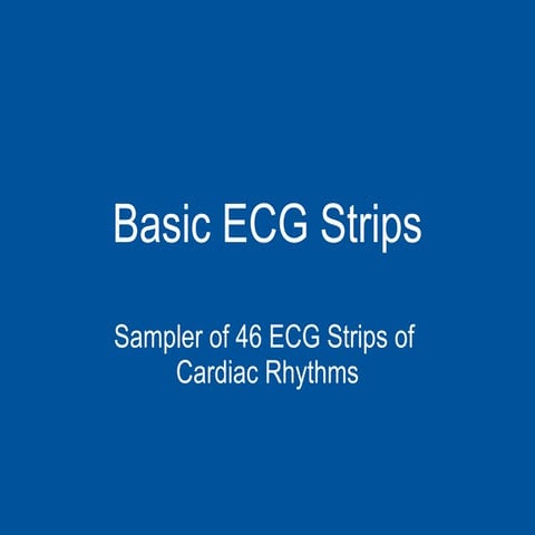 Basic ecg stripsnew