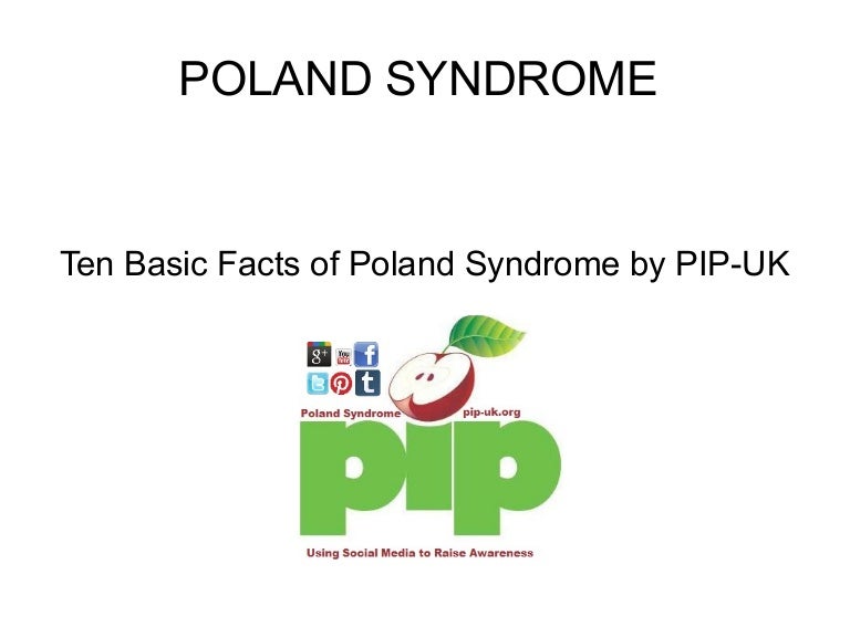 Poland Syndrome 10 Basic Facts