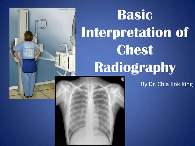 Basic interpretation of cxr