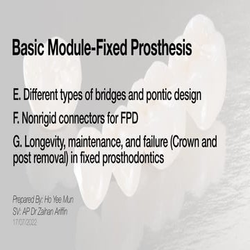 1. fixed partial denture finals1 | PPT