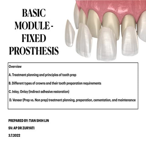 Principles of Tooth Preparation in Dentistry | PDF