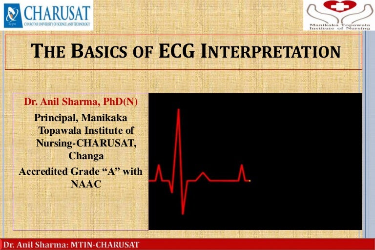 Basic Of Ecg Interpretation