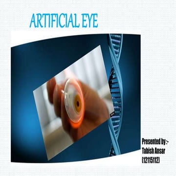 Basic overview of an artificial eye