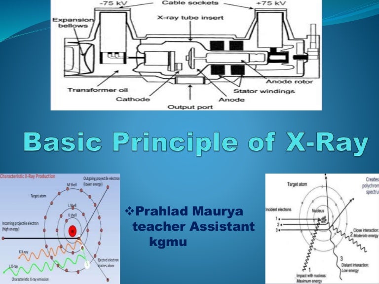 Basic principle of x ray