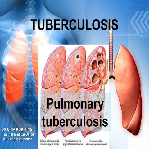 Basic pulmonary tuberculosis intro