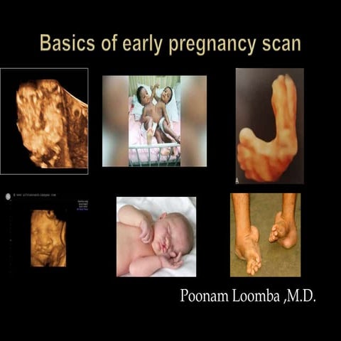Basics of early pregnancy scan.pptx