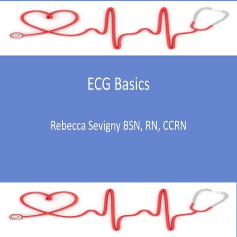 Basics of ecg