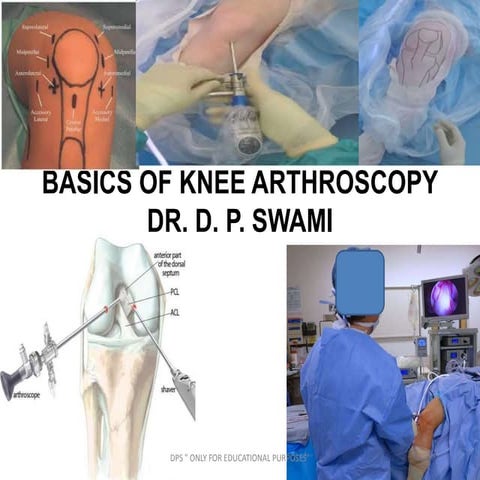 Basics of knee arthroscopy by dr. d. p. swami
