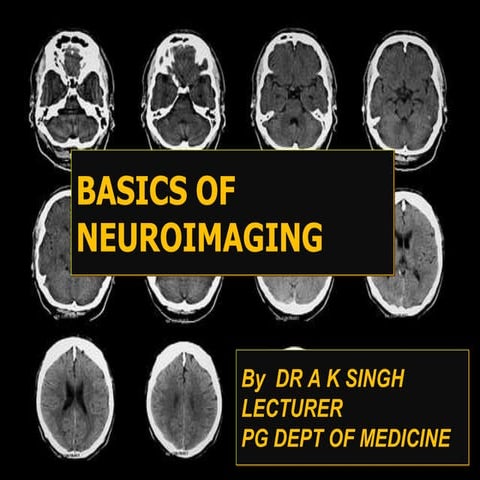 Basics of neuroimaging