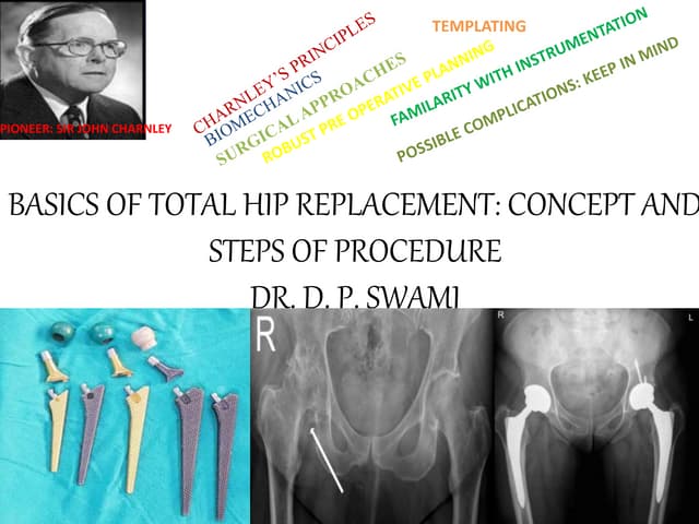 Basics of total hip replacement by DR. D. P. SWAMI | PPTX