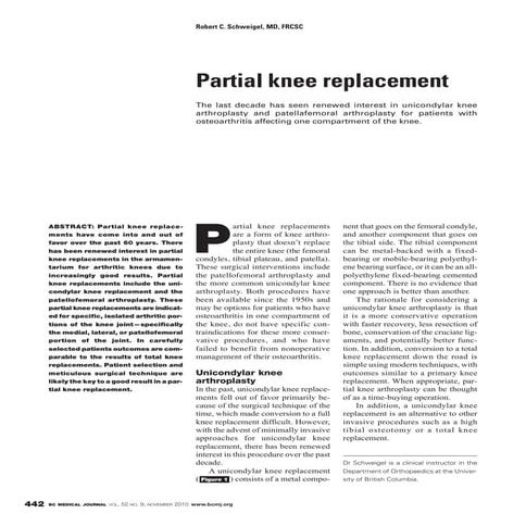 British Columbia Medical Journal - November 2010: Knee replacement