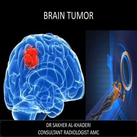 Brain Tumors