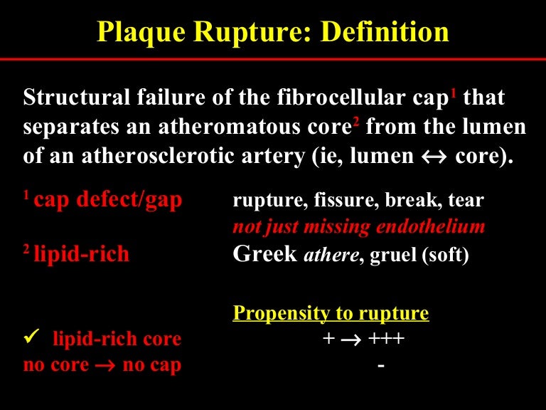 Plaque rupture definition