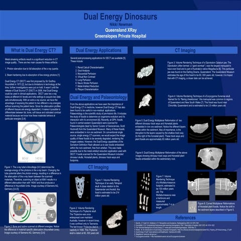 APPLICATION OF DUAL ENERGY CT IN EMERGENCY RADIOLOGY | PPTX