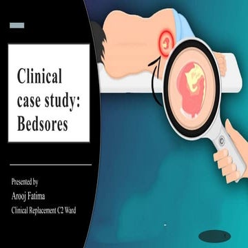 bedsores (8).pptx