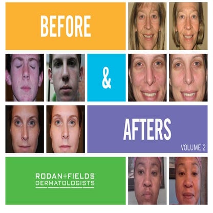 Before and after_ Rodan + Fields Product results