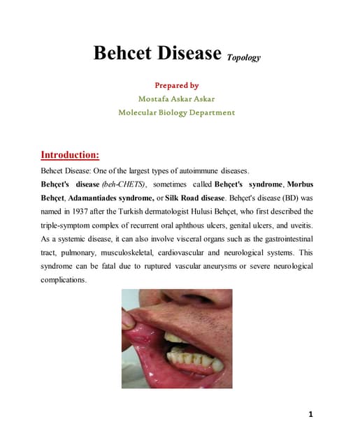 behcets disease | PPTX