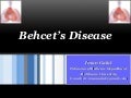 Behcet’s disease