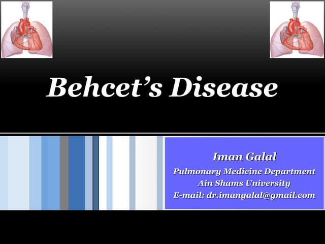 Behcet’s disease
