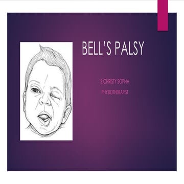 Bell's Palsy